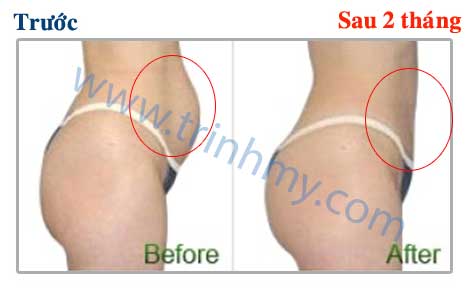Đông hủy mỡ Đông hủy mỡ
